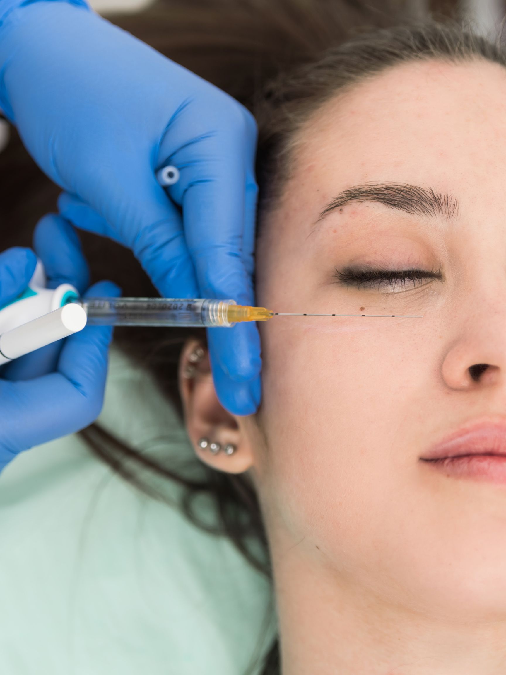 Best Under Eye Filler Near MeW Med Spa